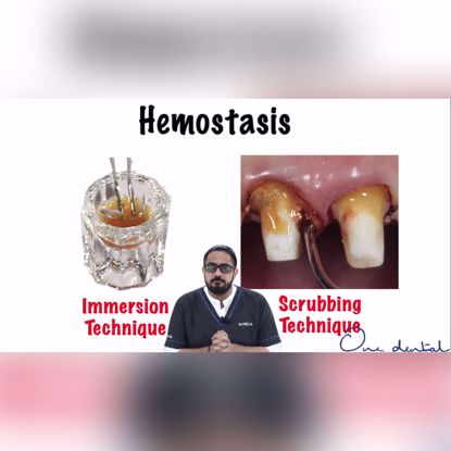 Picture of Techniques to achieve haemostasis prior to impression