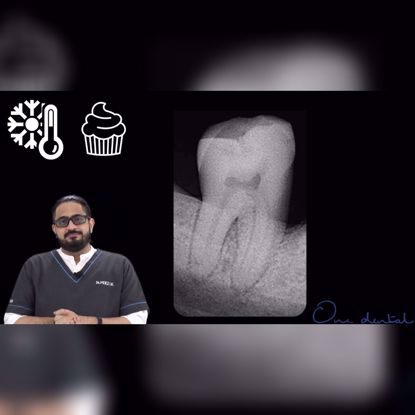 Picture of Sensitivity even after a root canal?