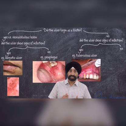 Picture of A step by step approach to diagnosing an ulcer