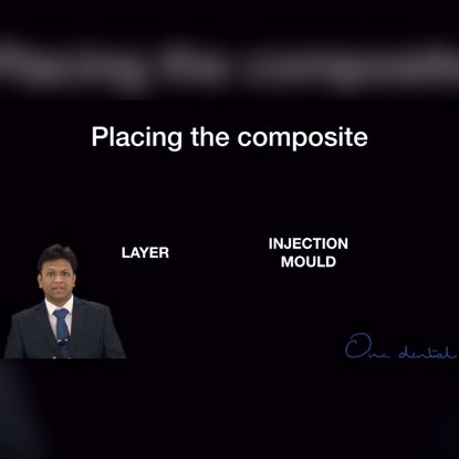 Picture of Layering vs Injection moulding composites