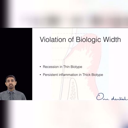 Picture of Understanding biologic width