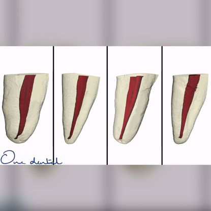 Picture of Minimally invasive endodontics