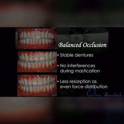 Picture of Predictable oral rehabilitation with complete dentures