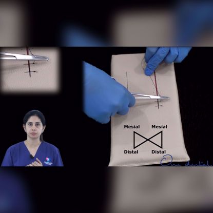 Picture of External horizontal mattress suture demonstration