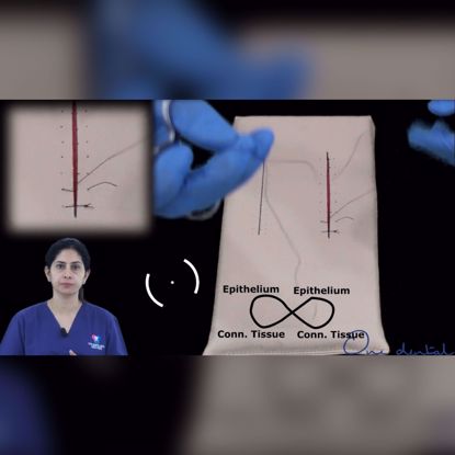 Picture of Figure of eight suture demonstration