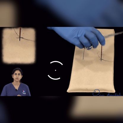 Picture of Interrupted direct loop suture demonstration