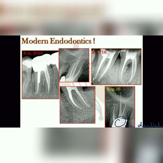 Integrated Endodontics-One Dental is the Biggest online platform for ...