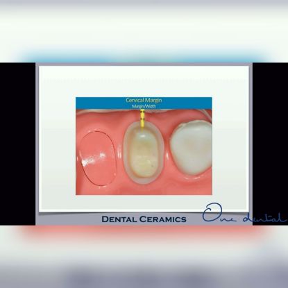 Picture of Dental ceramics
