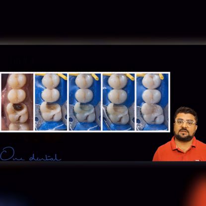 Picture of Importance of dental photography in dentistry
