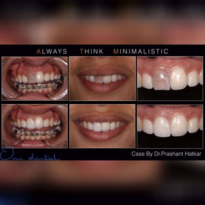 Picture of 7 secrets to success in aesthetic dentistry