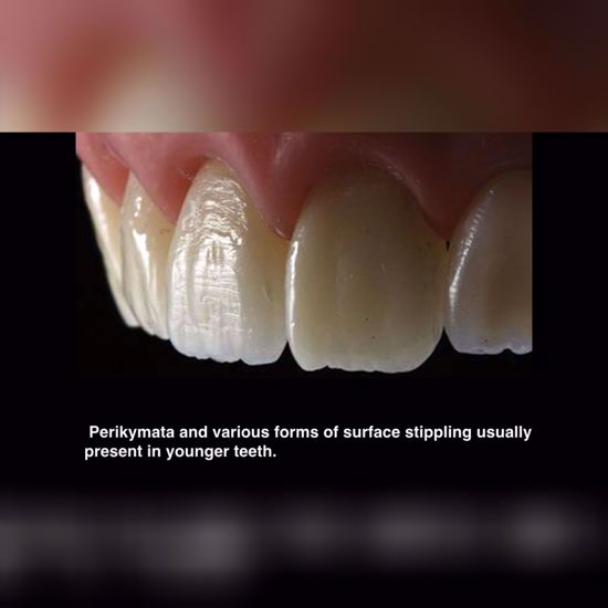 7 Tips For Highly Effective Composite Restorations-One Dental Is The ...