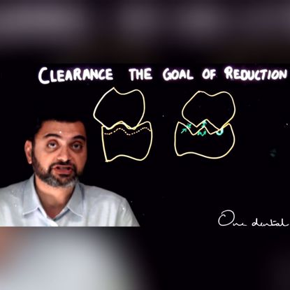 Picture of Clearance: The goal of reduction