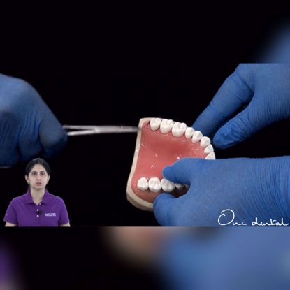 Picture of Anchor suture demonstration