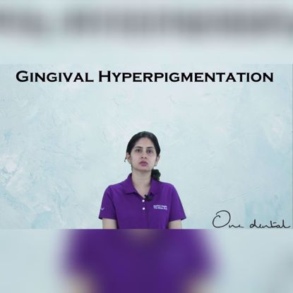 Picture of Overview on gingival hyperpigmentation
