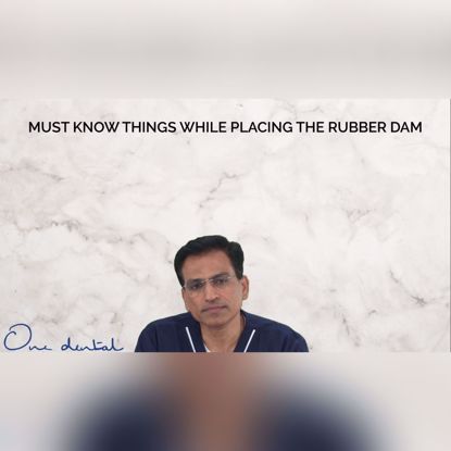 Picture of Must know things before rubber dam placement