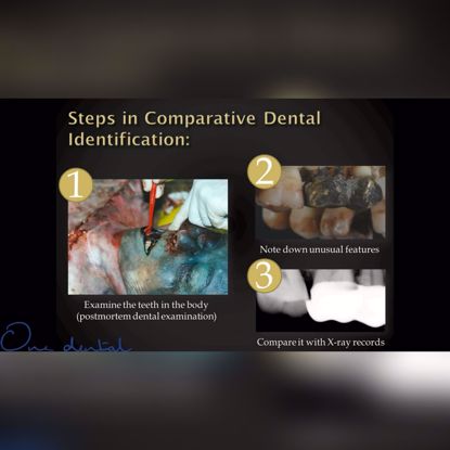 Picture of Forensic odontology