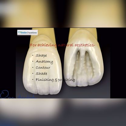 Picture of Achieving natural aesthetics in Class IV restorations