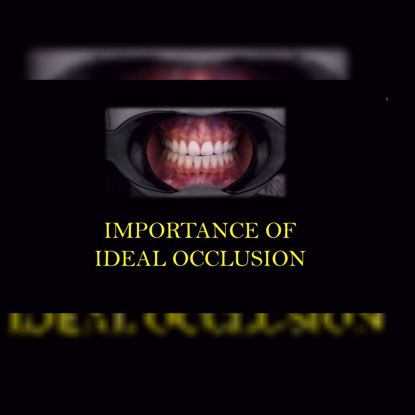 Picture of Importance of ideal occlusion