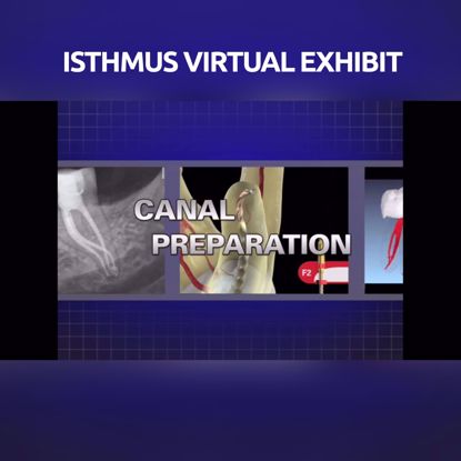 Picture of ISTHMUS VIRTUAL EXHIBIT: Endodontic canal preparation