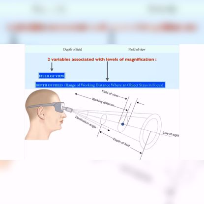 Picture of Introduction to Loupes